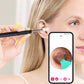 LUNAVA™ Pro Ohrenschmalz-Entfernungsgerät mit HD-Kamera