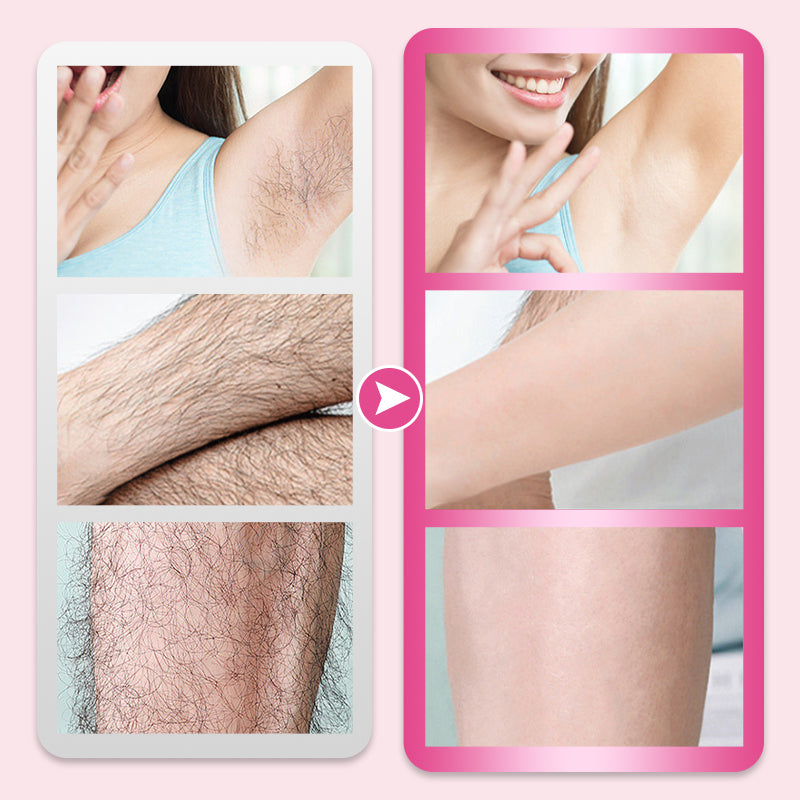 🌸Makellose und sanfte Haarentfernungscreme Nein👙Bikini-Saison Essentials