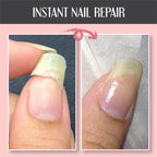 🌟2025 Schutzgel für Nagelreparatur💅 kaufen 2 Holen Sie sich 1 kostenlos