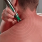 Muskelmassage Therapie Akupunktur Punkt Stift