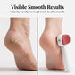 🦶 Double-Sided Foot Scraper – Removes calluses & dead skin easily – For smooth, baby-soft feet at home ✨