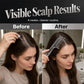 💆‍♀️ Scalp Applicator Comb Tool for Hair ✨ Targeted Scalp Treatment Comb