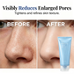 Blackhead Remover Clay Mask